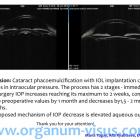 Yugay M.P., Ryabtseva A.A. (Югай М.П., Рябцева А.А., Moscow, Russia) Change in intraocular pressure in the early period after cataract phacoemulsification (EVER-2014). Офтальмологический портал Орган зрения www.organum-visus.com