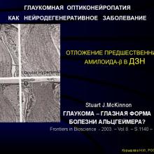 Курышева Н.И., профессор. Концепция глаукомной оптической нейропатии.   Центр офтальмологии  ФМБА России, г. Москва. Доклад на  V Российском общенациональном офтальмологическом форуме (РООФ2012, AROF2012), 04.10.2012г., Москва, Россия. Информационная поддержка www.organum-visus.com специально для www.eye-portal.ru