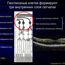 Курышева Н.И., профессор. Концепция глаукомной отптической нейропатии.   Центр офтальмологии  ФМБА России, г. Москва. Доклад на  V Российском общенациональном офтальмологическом форуме (РООФ2012, AROF2012), 04.10.2012г., Москва, Россия. Информационная поддержка www.organum-visus.com специально для www.eye-portal.ru