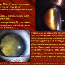 "Прикладная офтальмологи и": рабочая встреча 13.02.2013г, Диабетическая глаукома. Клинические примеры Липатов Д.В., заведующий отделением "Диабетическая ретинопатия и офтальмохирургия" ФГБУ ЭНЦ МЗ России. Портал Орган зрения www.organum-visus.com