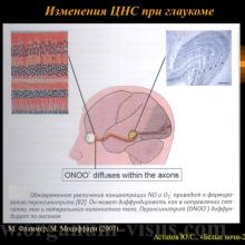 Астахов Ю.С. Некоторые аспекты патогенеза первичной открытоугольной глаукомы. Доклад на XX офтальмологическом конгрессе «Белые ночи-2014». Информационный партнер www.organum-visus.com