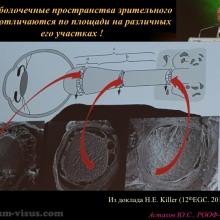 Астахов Ю.С. Глаукома и системные заболевания. Доклад на IX Российском общенациональном офтальмологическом форуме (РООФ-2016, Москва, Россия, 12 октября). Под эгидой Межрегиональной общественной организации «Ассоциация врачей – офтальмологов». Информационный партнер портал Орган зрения organum-visus.ru