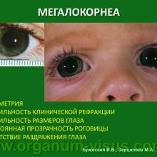 Бржеский В.В., Зерцалова М.А. Современные возможности лечения глаукомы у детей раннего возраста. Доклад на конференции «От проблемы рефракции – к проблеме глаукомы», Челябинск, 20 декабря 2013г. Glaucoma in Children. Информационный партнер www.organum-visus.com