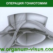 Бржеский В.В., Зерцалова М.А. Современные возможности лечения глаукомы у детей раннего возраста. Доклад на конференции «От проблемы рефракции – к проблеме глаукомы», Челябинск, 20 декабря 2013г. Glaucoma in Children. Информационный партнер www.organum-visus.com