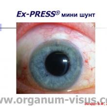 Экгардт В.Ф. НГСЭ и Ex-PRESS® мини шунт в сравнительном аспекте. Доклад на Краевой конференция офтальмологов "Прикамские зори: актуальные вопросы глаукомы", 27 марта 2015г., г. Пермь, Россия. Информационный партнер www.organum-visus.com (Glaucoma)