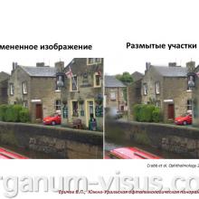 Еричев В.П. Лечение глаукомы взаимная ответственность врача и пациента. Доклад: Южно-Уральская офтальмологическая панорама, г. Челябинск, 18 декабря 2015 г. Информационный партнер портал Орган зрения www.organum-visus.com