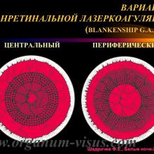 Шадричев Ф.Е. Сахарный диабет и нарушение офтальмотонуса. Доклад на сателлитном симпозиуме "Современные подходы к коррекции различных нарушений офтальмотонуса: можно ли избежать неизбежного?" (при поддержке компании "Эбботт Лэбораториз") в рамках офтальмологического конгресса Белые ночи-2015 (26 июня, г. Санкт-Петербург, Россия). Информационный партнер портал Орган зрения www.organum-visus.com
