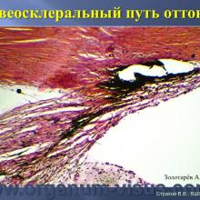 Страхов В.В. Увеосклеральный путь оттока: мифы и реальность, Uveoscleral outflow. Доклад, XII Всероссийская Школа офтальмолога, Снегири, 15 марта 2013г. Russian Glaucoma Society. Информационная поддержка www.organum-visus.com