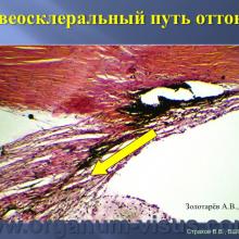 Страхов В.В. Увеосклеральный путь оттока: мифы и реальность, Uveoscleral outflow. Доклад, XII Всероссийская Школа офтальмолога, Снегири, 15 марта 2013г. Russian Glaucoma Society. Информационная поддержка www.organum-visus.com