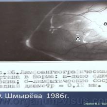 Страхов В.В. Увеосклеральный путь оттока: мифы и реальность, Uveoscleral outflow. Доклад, XII Всероссийская Школа офтальмолога, Снегири, 15 марта 2013г. Russian Glaucoma Society. Информационная поддержка www.organum-visus.com