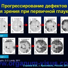 Страхов В.В. Главные патогенетические «противоречия» первичной глаукомы (г. Ярославль, Россия, 2014г.) Glaucoma pathogenesis. Информационный партнер www.organum-visus.com 