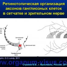 Страхов В.В. Главные патогенетические «противоречия» первичной глаукомы (г. Ярославль, Россия, 2014г.) Glaucoma pathogenesis. Информационный партнер www.organum-visus.com 