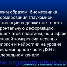 Страхов В.В. Главные патогенетические «противоречия» первичной глаукомы (г. Ярославль, Россия, 2014г.) Glaucoma pathogenesis. Информационный партнер www.organum-visus.com 