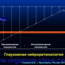 Страхов В.В. Главные патогенетические «противоречия» первичной глаукомы (г. Ярославль, Россия, 2014г.) Glaucoma pathogenesis. Информационный партнер www.organum-visus.com 