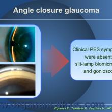 Egorova E., Tukhtaev K., Fayzieva U. Morphologic features of anterior lens capsule in the primary angle-closure glaucoma with pseudoexfoliative syndrome. 2012, февраль, 20. XXXIII World Ophthalmology Congress, Абу-Даби.