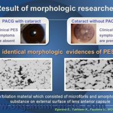 Egorova E., Tukhtaev K., Fayzieva U. Morphologic features of anterior lens capsule in the primary angle-closure glaucoma with pseudoexfoliative syndrome. 2012, февраль, 20. XXXIII World Ophthalmology Congress, Абу-Даби.