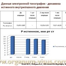 Югай М.П., Рябцева А.А. Анатомо-топографические и гидродинамические изменения глаза при псевдоэксфолиативной глаукоме после ФЭК. Доклад на Всероссийском конгрессе "Глаукома на рубеже веков", 5-6 сентября 2013г. г. Казань. Media Partner www.organum-visus.com