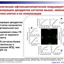 Зуева М.В. Доклинические тесты диагностики глаукомы и их роль в практическом здравоохранении. Доклад на первом Научно-практическом заседании Экспертного Совета по глаукоме. Тематика: Современные подходы к диагностике и терапии глаукомы, 14 октября 2016 (Москва), под эгидой Общероссийской общественной организации "Ассоциация врачей-офтальмологов". Информационный партнер organum-visus.ru